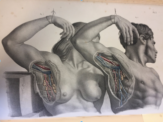 Male and Female lymph node dissection from Surgical Anatomy by Joseph Maclise (1851).