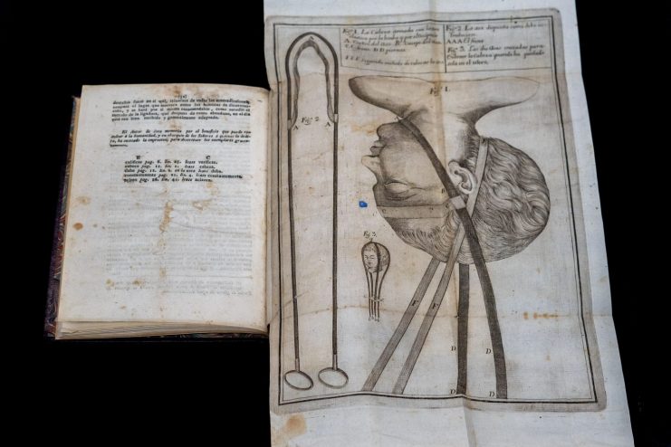 An open text with a fold-out illustration showing a forceps delivery