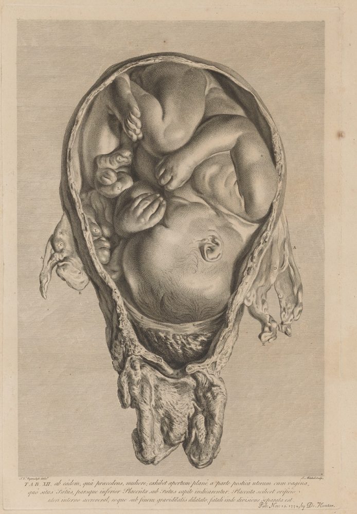 Hunter, William. Anatomia uteri humani gravidi tabula illustrata. Birmingham, 1774. Courtesy of the Wangensteen Historical Library